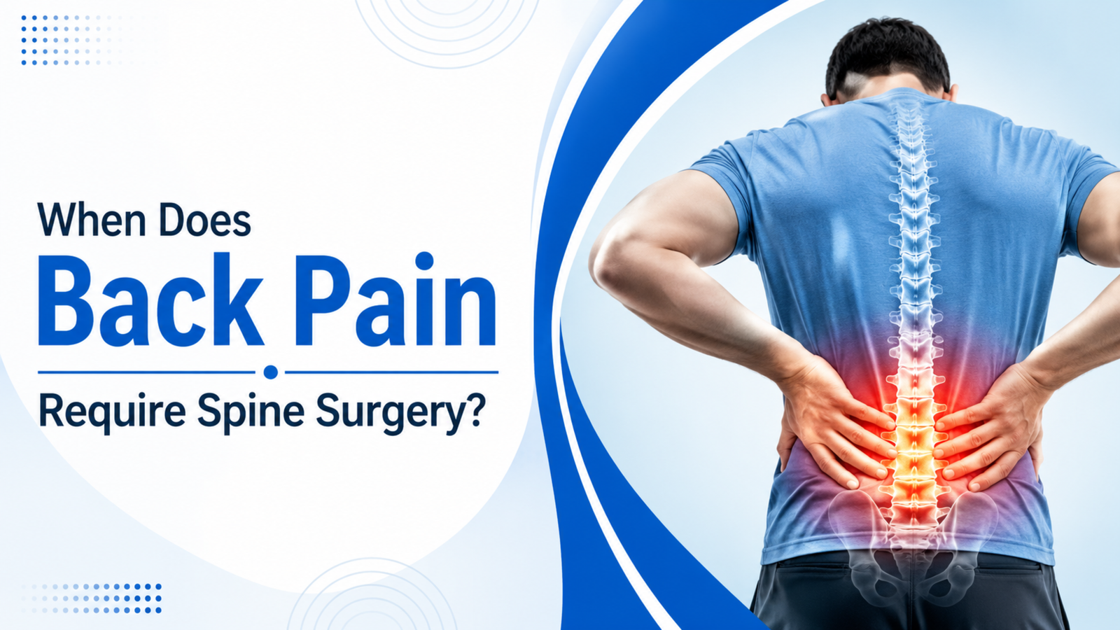 When Does Back Pain Require Spine Surgery?