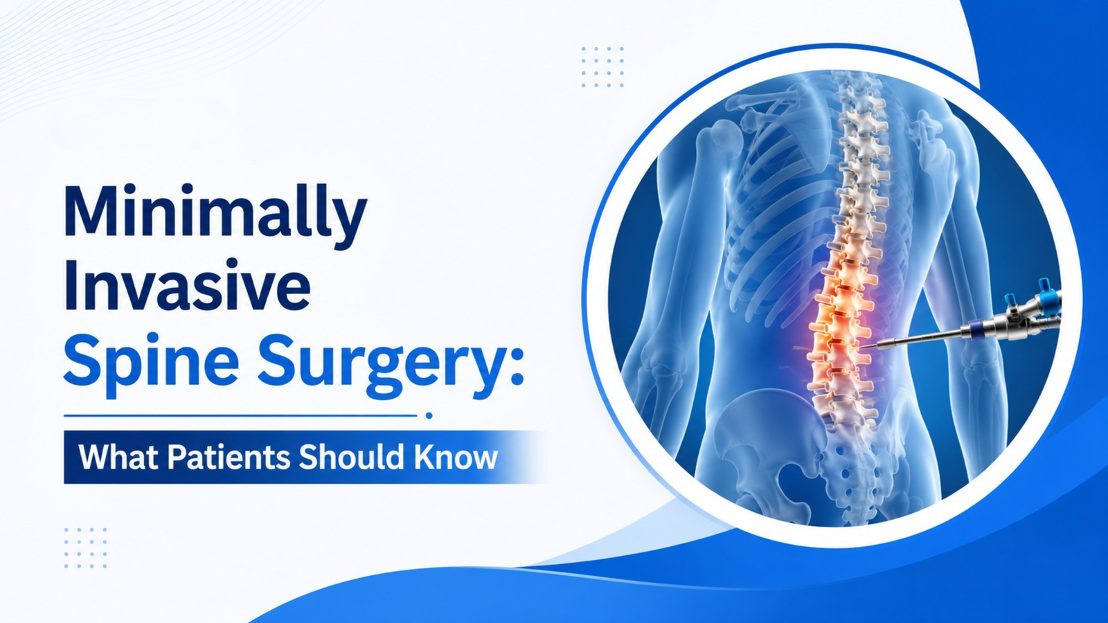Minimally Invasive Spine Surgery: What Patients Should Know