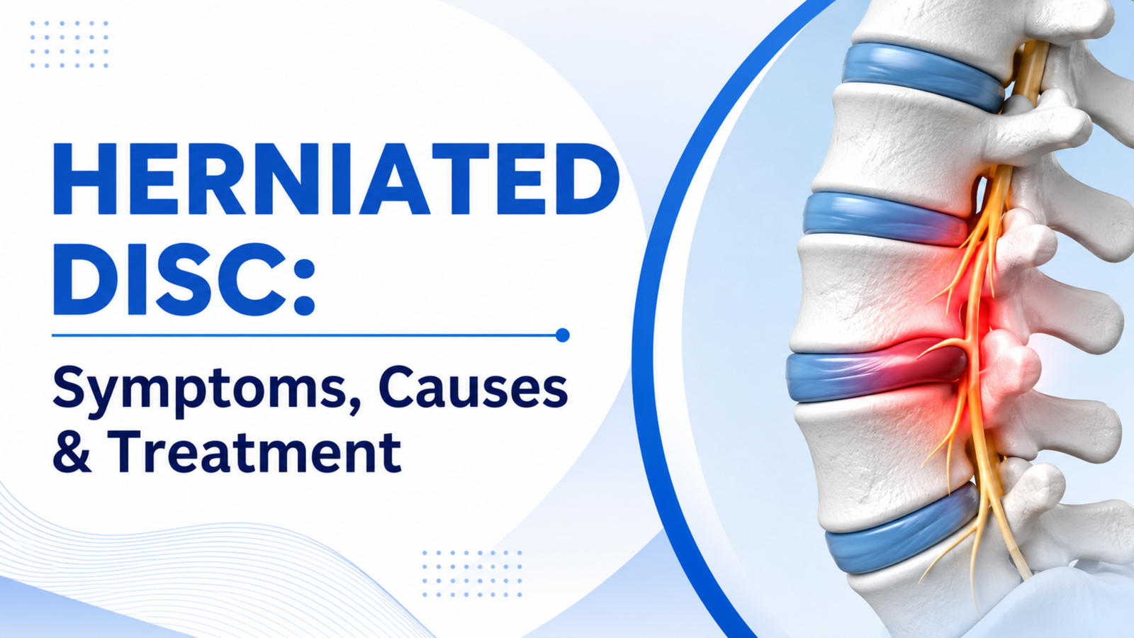 Herniated Disc: Symptoms, Causes & Treatment